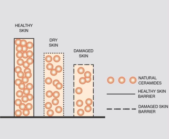 Depiction of healthy vs damaged skin cells